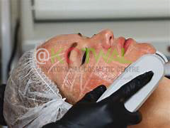 Lasers/IPL